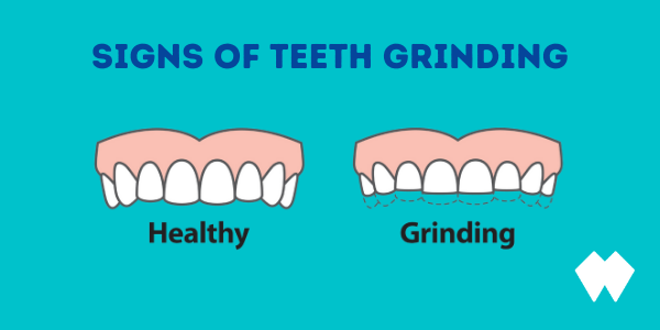 Symptoms of Teething Grinding and Bruxism